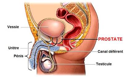 cancer prostate