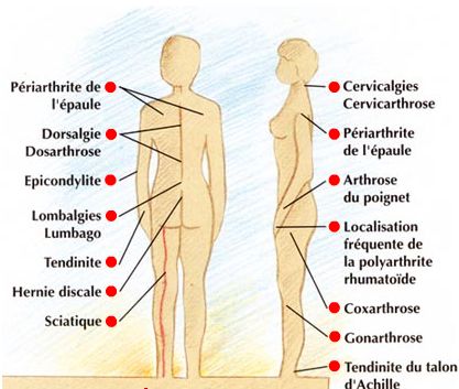 Soulagement Arthroflex